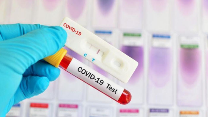 Нов вариант на коронавируса е бил регистриран в Перу, като