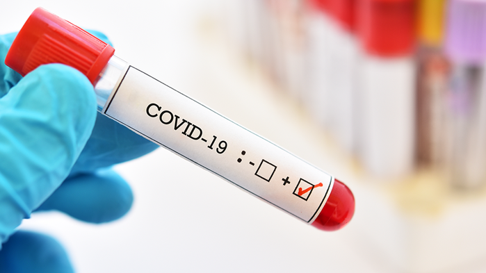 462 са новодиагностицираните с COVID-19 лица у нас за изминалите