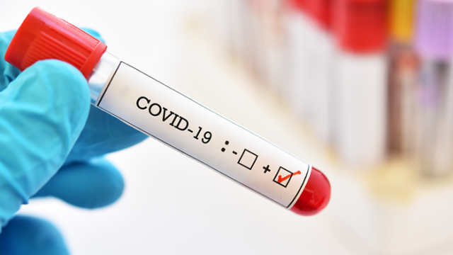 462 са новодиагностицираните с COVID 19 лица у нас за изминалите