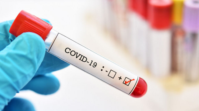  За последното денонощие новите случаи на COVID 19 у нас са