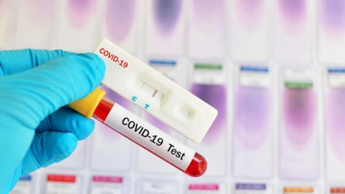 Имунолог от Цюрих: COVID-22 може да бъде дори по-лош от това, с което се срещаме сега