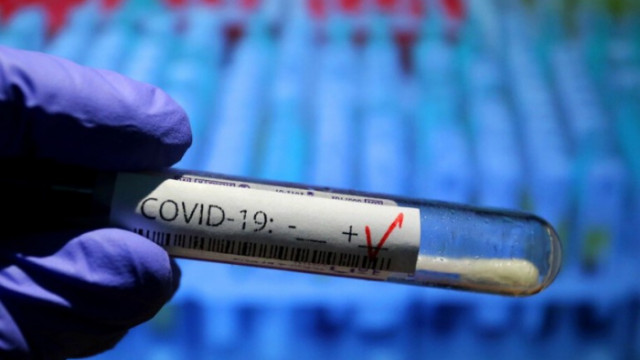 Албания регистрира сериозен скок на новите случаи на коронавирусна инфекция