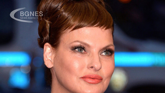 Бившият супермодел Линда Еванджелиста призна, че е била обезобразена за