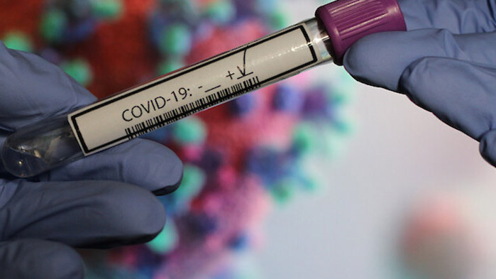 Броят на заразените с коронавируса (COVID-19) в света от началото