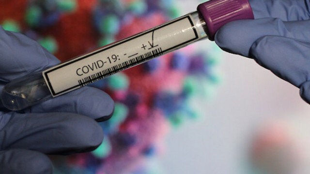 Броят на заразените с коронавируса COVID 19 в света от началото
