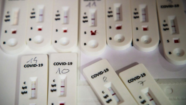 В петък Франция спря да предлага безплатни тестове за коронавирус