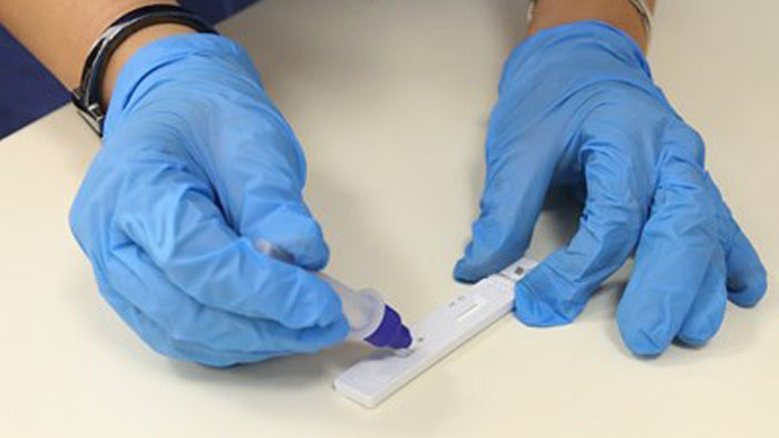 - Заразените паднаха с 31% за седмица до 2800, но починалите все