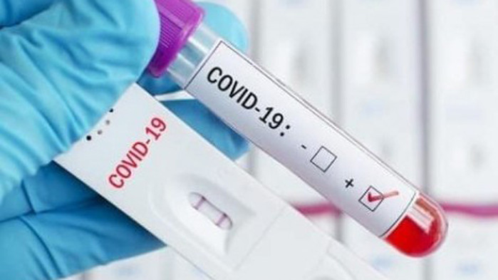 177 са новите регистрирани случаи на заразени с Covid-19 във