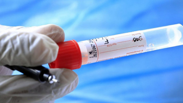 След като в средата на декември България излезе от тъмночервената