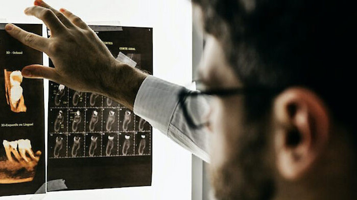 Премахването на мъдреците вече е традиционно за много хора в