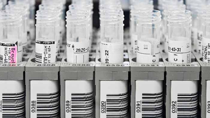 157 нови случая на COVID-19 у нас, почти два пъти повече са излекуваните