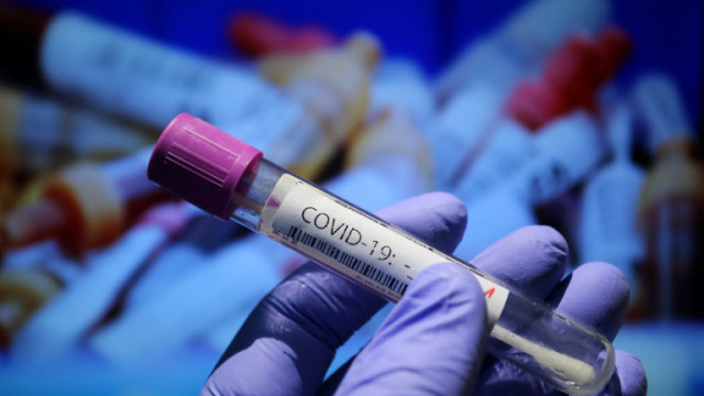 Установиха огнище на коронавирус в психиатричната болница в Балчик съобщава
