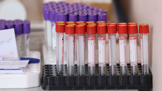 В Нидерландия 97 от донорите в кръвните банки имат антитела срещу коронавируса съобщи