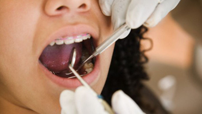 Осигуриха достъп до стоматологични услуги за бежанците от Украйна във Варна