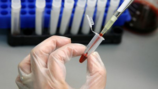 Нидерландски учени откриха за първи път микропластмаса в човешка кръв
