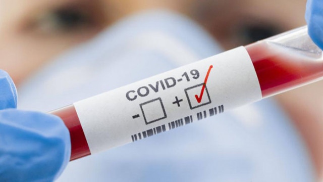 1176 са новите случаи на коронавирус у нас с 522