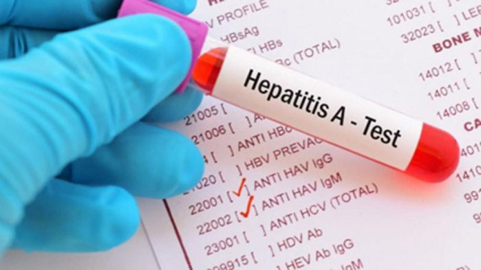 Необясними случаи на хепатит при деца са засечени в Европа и САЩ
