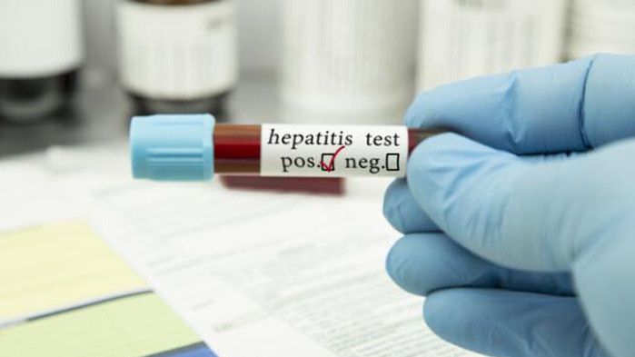 Мистериозният щам на хепатит при децата достигна до Азия и Канада