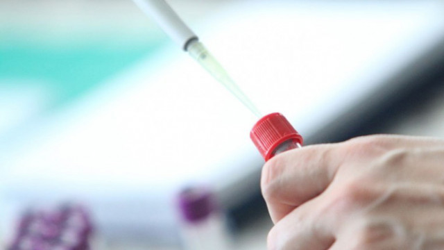 СЗО е открила над 90 заболели в 12 страни Първи