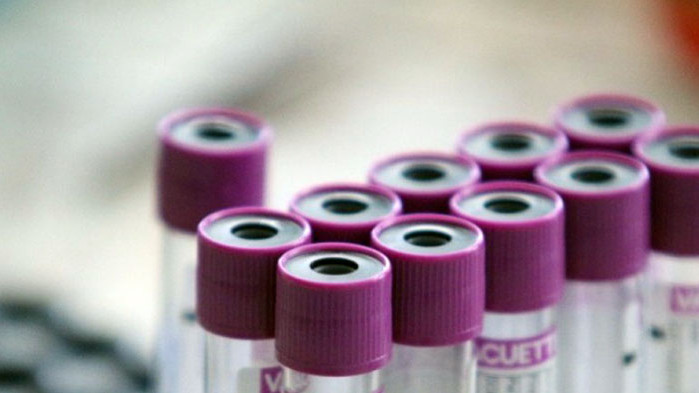 От днес в болниците в Мадрид ще започнат тестове за