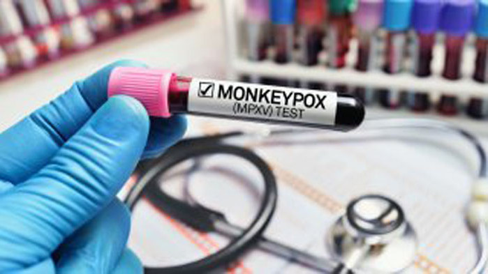 Доц. Гломб очаква още случаи на маймунска вариола, но не и епидемия