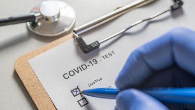 МЗ предлага личните лекари да издават направления за бърз антигенен тест за COVID-19