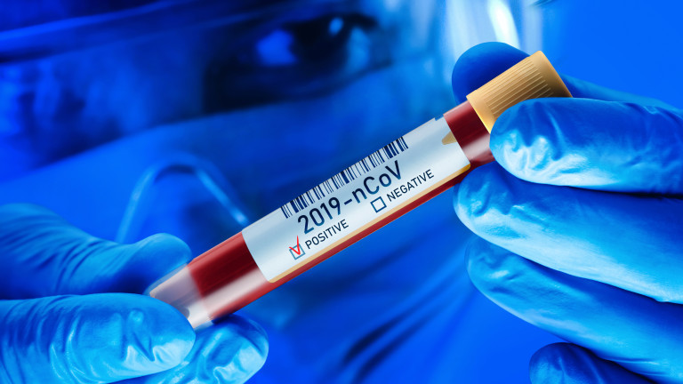 PCR и антигенните тестове да бъдат върнати към личните лекари
