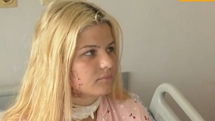Момичето, ударено от мълния в Поморие: Живея втори живот