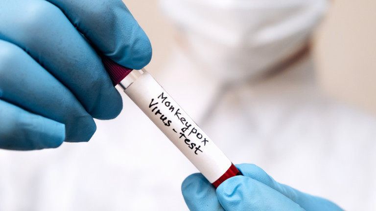 Шести случай на маймунска вариола у нас е потвърден днес в