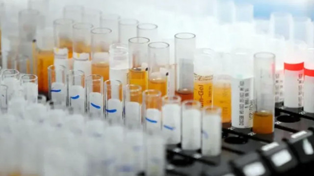 В НЦЗПБ чрез целогеномно секвениране са анализирани 332 клинични проби със