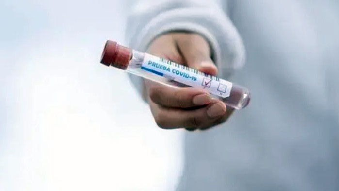 212 са новите случаи на коронавирус у нас при направени