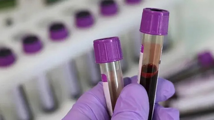 30 души са заразени с вируса на ХИВ от началото