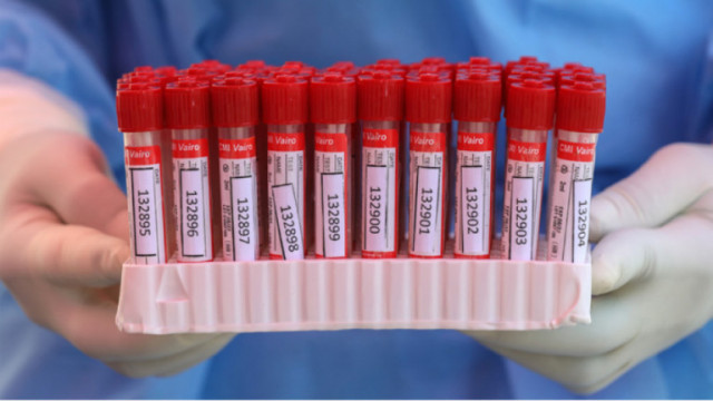 220 са новите случаи на коронавирус у нас Направени са 1