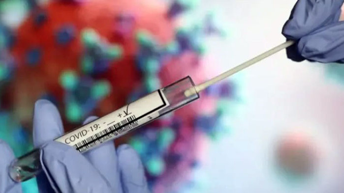 577 са новите случаи на коронавирус у нас за последните