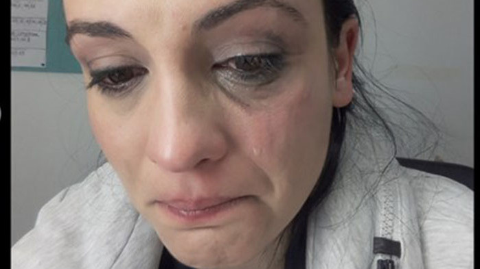 Диана Димитрова: Насилникът ми ме псуваше на майка и ме изрита в лицето със стабилен шут
