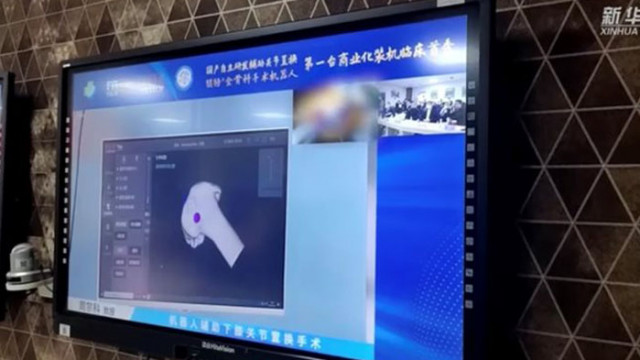 Независимо разработен в Китай робот успешно извърши операция за смяна