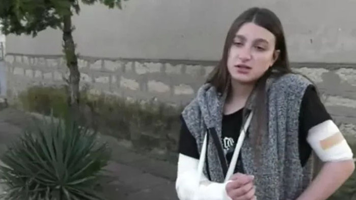Домашни кучета нападнаха жестоко 12-годишно дете