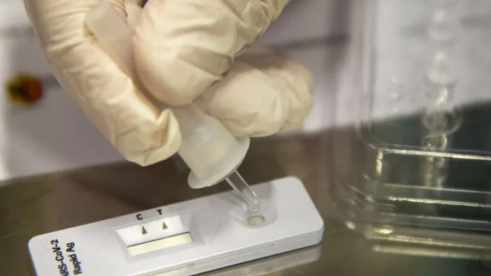 173 са новите случаи на коронавирус са били регистрирани за