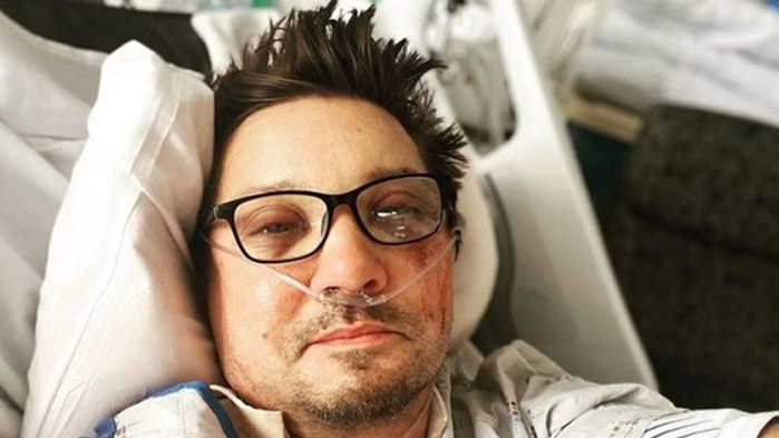 Смята се, че Джеръми Ренър е в много по-лошо състояние