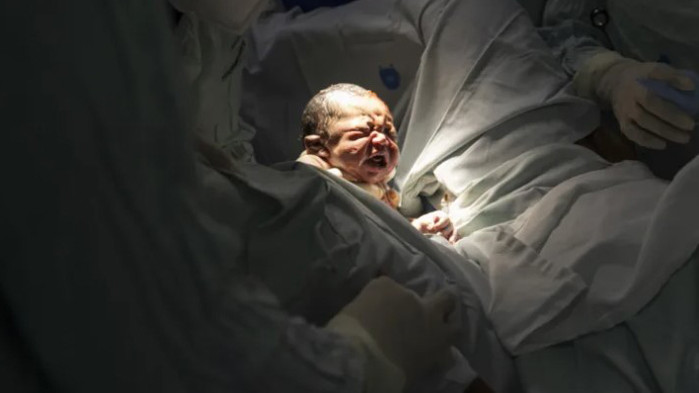 Бавят се доставки на медикаменти за анестезия при секцио. От