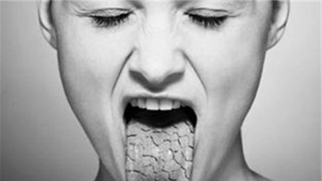 Устата пресъхва, езикът залепва за небцето - може би е болест