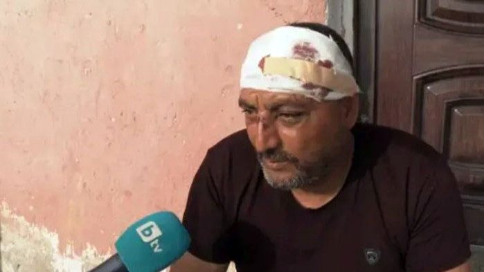 Един от пострадалите при масовия бой в Казанлък: Нападнаха ме, когато излязох от колата