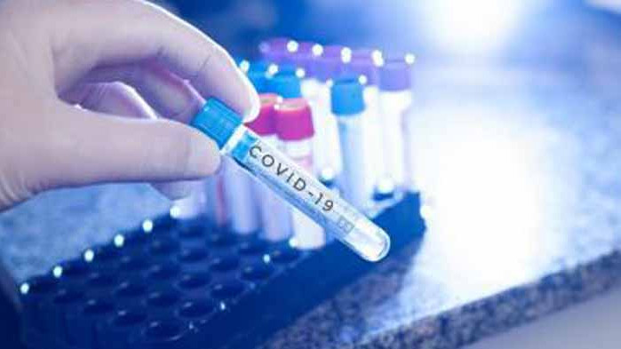 Нови 188 случая на COVID-19 у нас, починали са 13 души