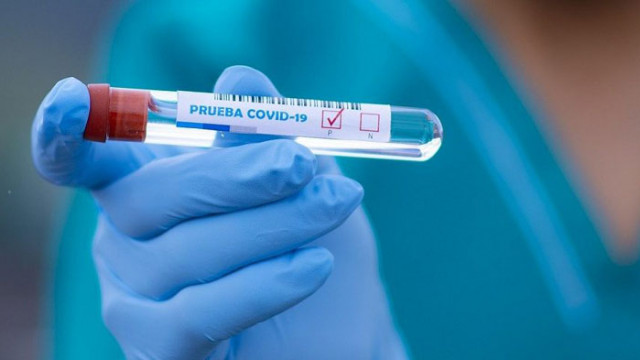 5 нови случая на COVID-19 за последното денонощие в област Русе