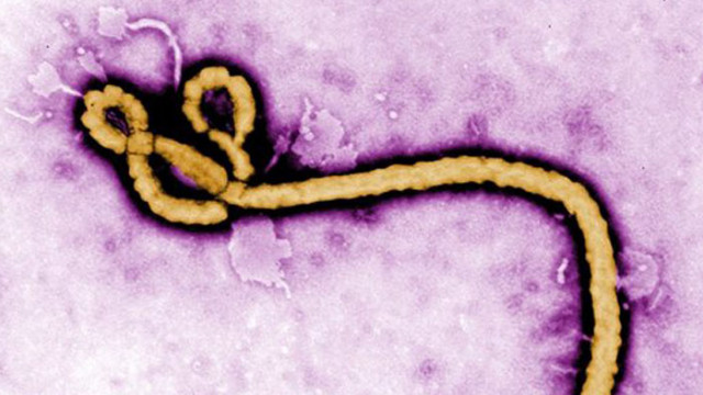 Изследователи описват първи в света случай на нова паразитна инфекция