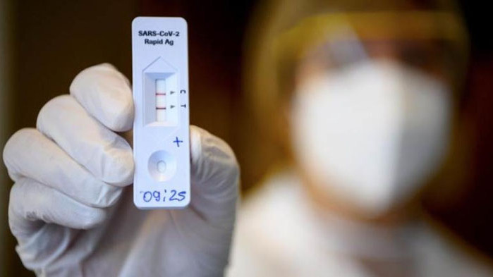 214 са новите случаи на коронавирус у нас. Направени са