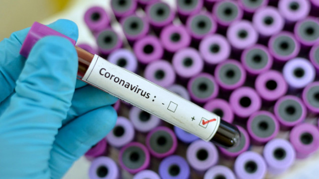 90 са новите случаи на коронавирус у нас