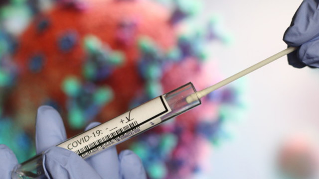 7 са новите случаи на коронавирус у нас за последното