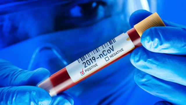 8 са новите случаи на коронавирус у нас