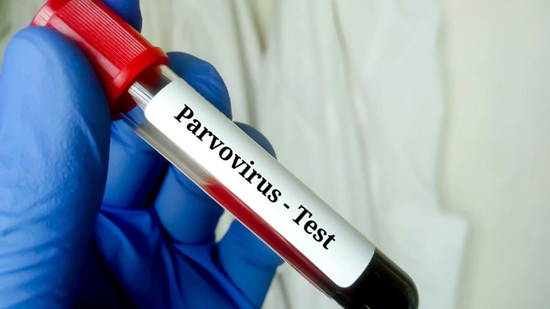 Дете почина от парвовирус - какви са симптомите?